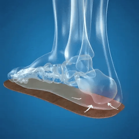 5. Helps With Plantar Fasciitis